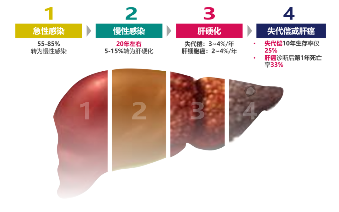 悄悄变成肝硬化、肝癌，很多人感染了却不知道